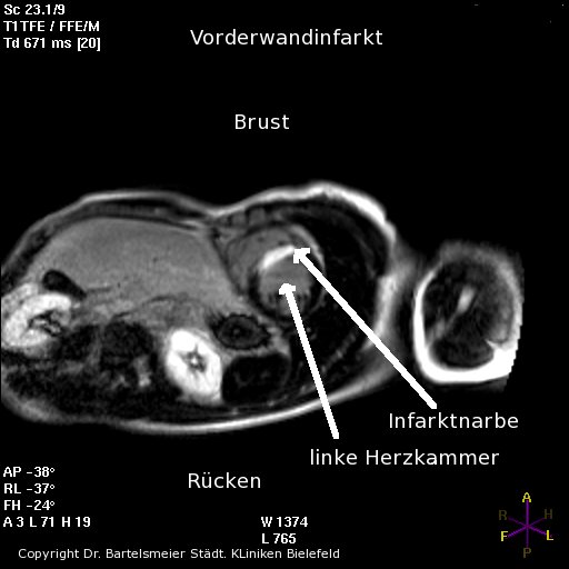 TheHeart.de - KHK-Untersuchungs-Techniken